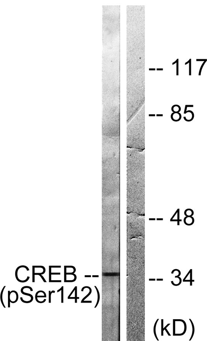 CREB-1 (phospho Ser142) Rabbit Polyclonal Antibody | 兔多抗 | EnkiLife恩玑生命