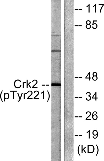 Crk II (phospho Tyr221) Rabbit Polyclonal Antibody | 兔多抗 | EnkiLife恩玑生命