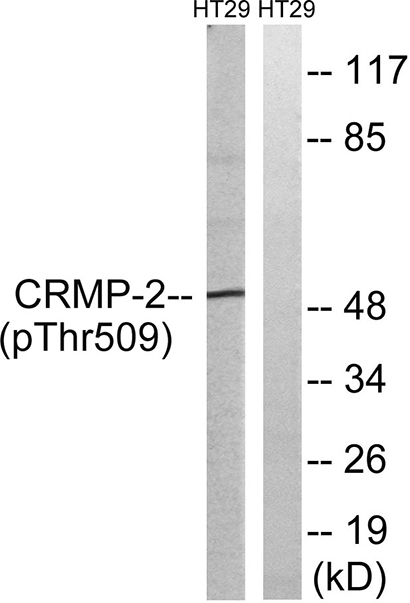 CRMP-2 (phospho Thr509) Rabbit Polyclonal Antibody | 兔多抗 | EnkiLife恩玑生命
