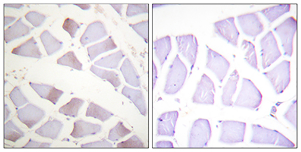 Crystallin-αB (phospho Ser19) Rabbit Polyclonal Antibody | 兔多抗 | EnkiLife恩玑生命