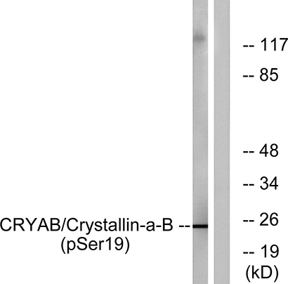 Crystallin-αB (phospho Ser19) Rabbit Polyclonal Antibody | 兔多抗 | EnkiLife恩玑生命