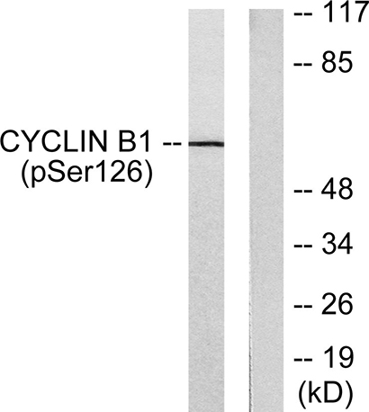 Cyclin B1 (phospho Ser126) Rabbit Polyclonal Antibody | 兔多抗 | EnkiLife恩玑生命