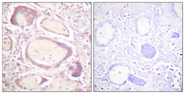 Cyclin B1 (phospho Ser147) Rabbit Polyclonal Antibody | 兔多抗 | EnkiLife恩玑生命