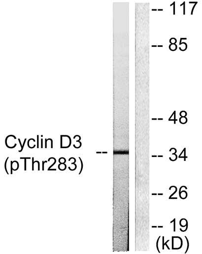 Cyclin D3 (phospho Thr283) Rabbit Polyclonal Antibody | 兔多抗 | EnkiLife恩玑生命