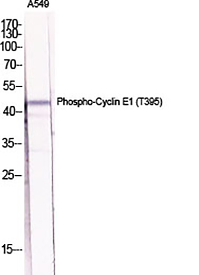 Cyclin E1 (phospho Thr395) Rabbit Polyclonal Antibody | 兔多抗 | EnkiLife恩玑生命