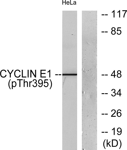 Cyclin E1 (phospho Thr395) Rabbit Polyclonal Antibody | 兔多抗 | EnkiLife恩玑生命
