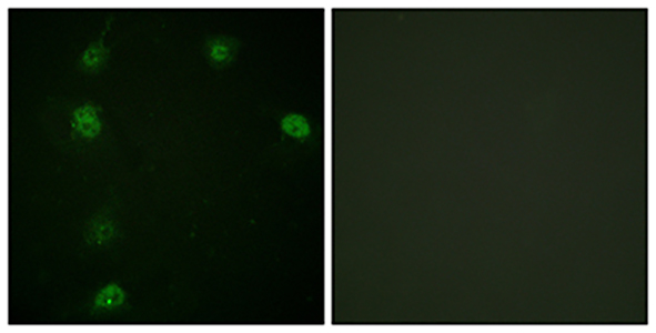 Cyclin E1 (phospho Thr77) Rabbit Polyclonal Antibody | 兔多抗 | EnkiLife恩玑生命