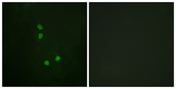 Cyclin E2 (phospho Thr392) Rabbit Polyclonal Antibody | 兔多抗 | EnkiLife恩玑生命