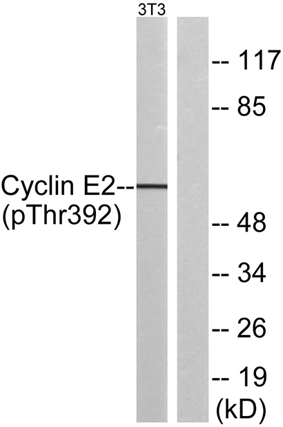 Cyclin E2 (phospho Thr392) Rabbit Polyclonal Antibody | 兔多抗 | EnkiLife恩玑生命