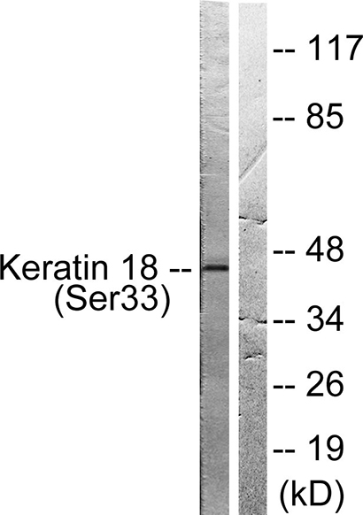 Cytokeratin 18 (phospho Ser33) Rabbit Polyclonal Antibody | 兔多抗 | EnkiLife恩玑生命