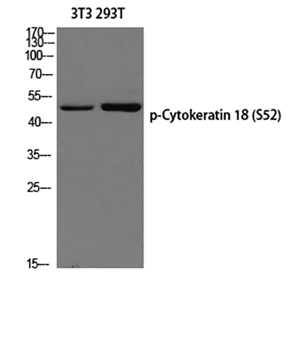 Cytokeratin 18 (phospho Ser52) Rabbit Polyclonal Antibody | 兔多抗 | EnkiLife恩玑生命