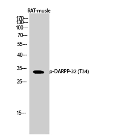 DARPP-32 (phospho Thr34) Rabbit Polyclonal Antibody | 兔多抗 | EnkiLife恩玑生命