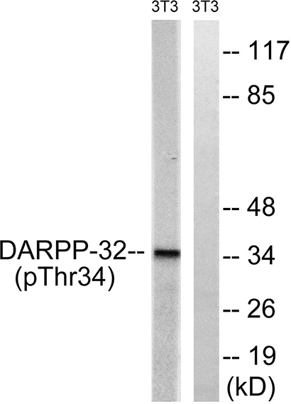 DARPP-32 (phospho Thr34) Rabbit Polyclonal Antibody | 兔多抗 | EnkiLife恩玑生命
