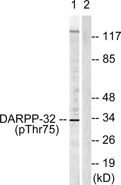 DARPP-32 (phospho Thr75) Rabbit Polyclonal Antibody | 兔多抗 | EnkiLife恩玑生命