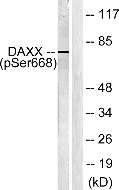 Daxx (phospho Ser668) Rabbit Polyclonal Antibody | 兔多抗 | EnkiLife恩玑生命