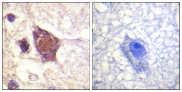 DDX3 (phospho Thr322) Rabbit Polyclonal Antibody | 兔多抗 | EnkiLife恩玑生命