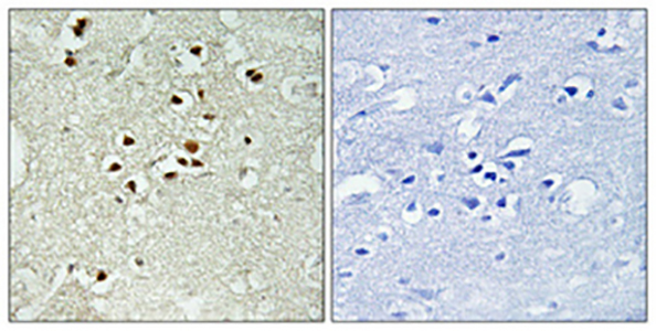 DNA Ligase IV (phospho Thr650) Rabbit Polyclonal Antibody | 兔多抗 | EnkiLife恩玑生命