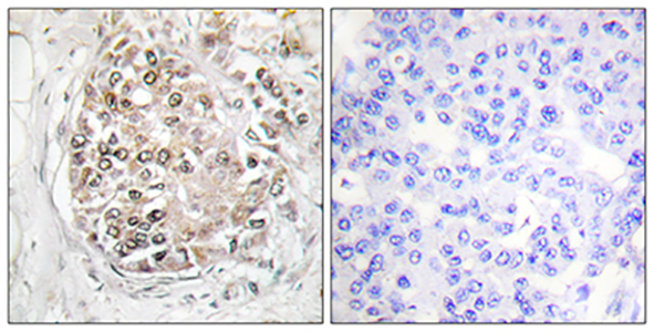 DNA-PKCS (phospho Ser2056) Rabbit Polyclonal Antibody | 兔多抗 | EnkiLife恩玑生命