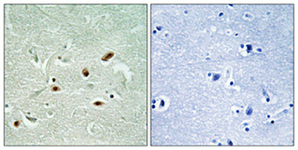 DNA-PKCS (phospho Ser2612) Rabbit Polyclonal Antibody | 兔多抗 | EnkiLife恩玑生命