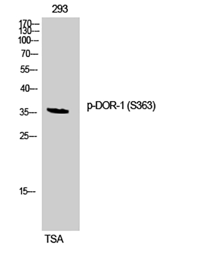 DOR-1 (phospho Ser363) Rabbit Polyclonal Antibody | 兔多抗 | EnkiLife恩玑生命