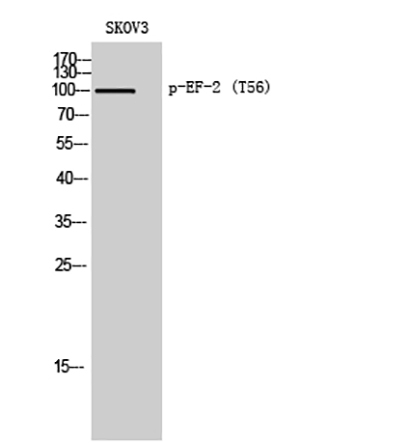 EF-2 (phospho Thr56) Rabbit Polyclonal Antibody | 兔多抗 | EnkiLife恩玑生命