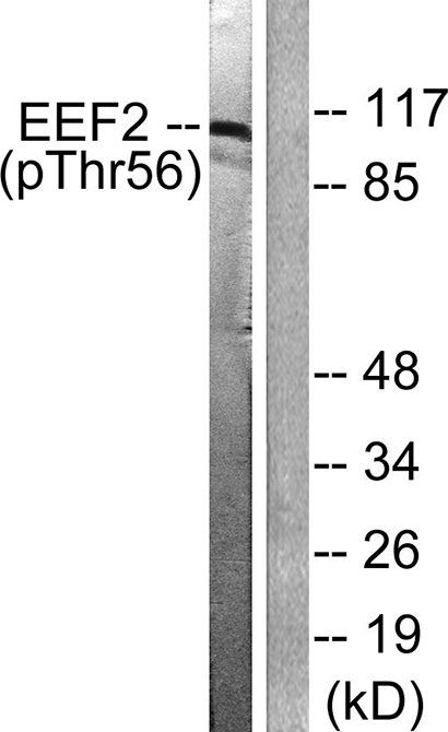 EF-2 (phospho Thr56) Rabbit Polyclonal Antibody | 兔多抗 | EnkiLife恩玑生命