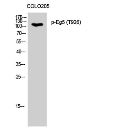 Eg5 (phospho Thr926) Rabbit Polyclonal Antibody | 兔多抗 | EnkiLife恩玑生命