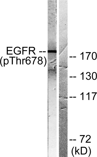 EGFR (phospho Thr678) Rabbit Polyclonal Antibody | 兔多抗 | EnkiLife恩玑生命