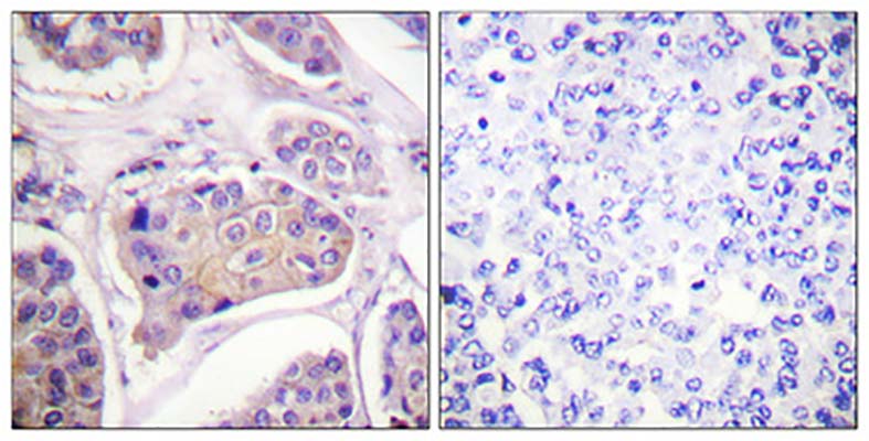 EGFR (phospho Tyr1016) Rabbit Polyclonal Antibody | 兔多抗 | EnkiLife恩玑生命