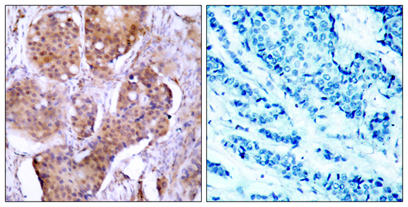 ERα (phospho Ser106) Rabbit Polyclonal Antibody | 兔多抗 | EnkiLife恩玑生命