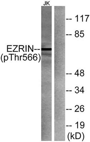 Ezrin (phospho Thr566) Rabbit Polyclonal Antibody | 兔多抗 | EnkiLife恩玑生命