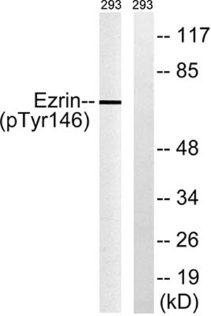 Ezrin (phospho Tyr146) Rabbit Polyclonal Antibody | 兔多抗 | EnkiLife恩玑生命