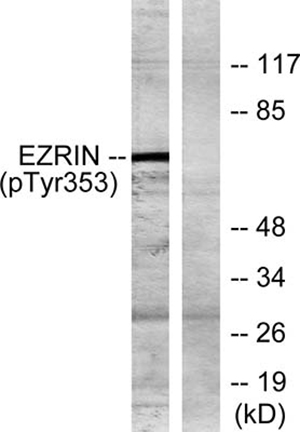 Ezrin (phospho Tyr353) Rabbit Polyclonal Antibody | 兔多抗 | EnkiLife恩玑生命
