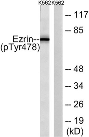Ezrin (phospho Tyr478) Rabbit Polyclonal Antibody | 兔多抗 | EnkiLife恩玑生命