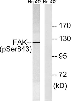 FAK (phospho Ser843) Rabbit Polyclonal Antibody | 兔多抗 | EnkiLife恩玑生命