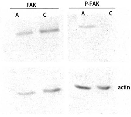 FAK (phospho Ser843) Rabbit Polyclonal Antibody | 兔多抗 | EnkiLife恩玑生命