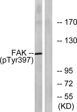 FAK (phospho Tyr397) Rabbit Polyclonal Antibody | 兔多抗 | EnkiLife恩玑生命