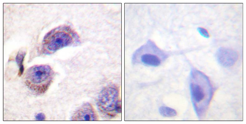 FAK (phospho Tyr407) Rabbit Polyclonal Antibody | 兔多抗 | EnkiLife恩玑生命