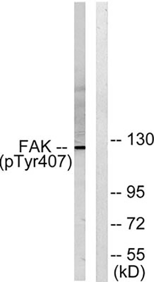 FAK (phospho Tyr407) Rabbit Polyclonal Antibody | 兔多抗 | EnkiLife恩玑生命