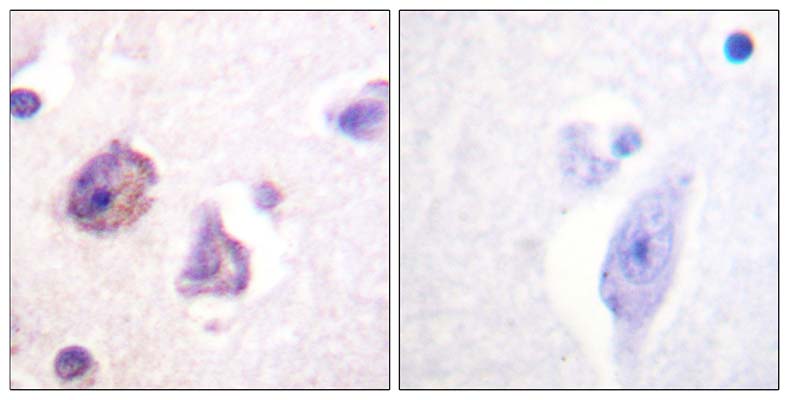 FAK (phospho Tyr576) Rabbit Polyclonal Antibody | 兔多抗 | EnkiLife恩玑生命