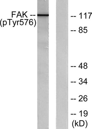 FAK (phospho Tyr576) Rabbit Polyclonal Antibody | 兔多抗 | EnkiLife恩玑生命