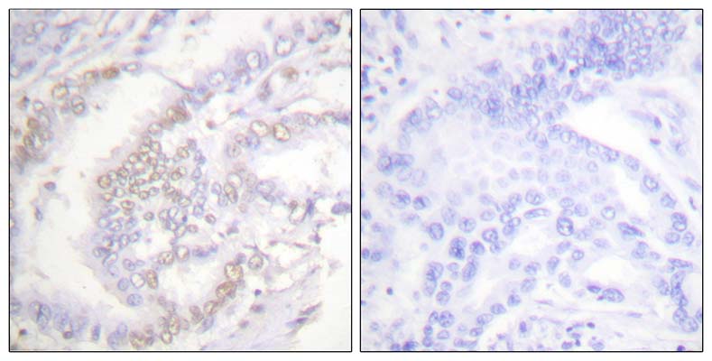 FANCD2 (phospho Ser222) Rabbit Polyclonal Antibody | 兔多抗 | EnkiLife恩玑生命