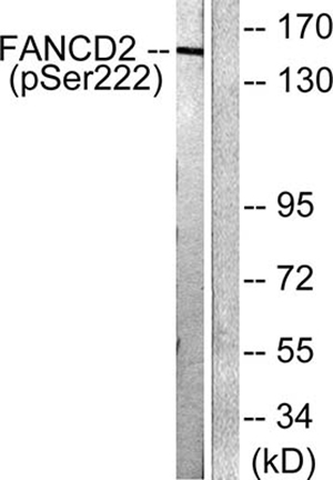 FANCD2 (phospho Ser222) Rabbit Polyclonal Antibody | 兔多抗 | EnkiLife恩玑生命