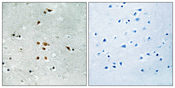 Fer (phospho Tyr402) Rabbit Polyclonal Antibody | 兔多抗 | EnkiLife恩玑生命