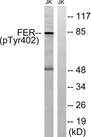 Fer (phospho Tyr402) Rabbit Polyclonal Antibody | 兔多抗 | EnkiLife恩玑生命