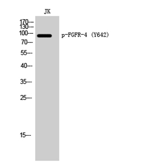FGFR-4 (phospho Tyr642) Rabbit Polyclonal Antibody | 兔多抗 | EnkiLife恩玑生命