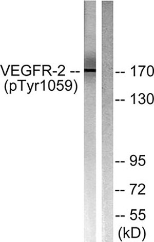 Flk-1 (phospho Tyr1059) Rabbit Polyclonal Antibody | 兔多抗 | EnkiLife恩玑生命