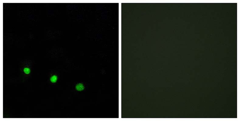 Fos B (phospho Ser27) Rabbit Polyclonal Antibody | 兔多抗 | EnkiLife恩玑生命