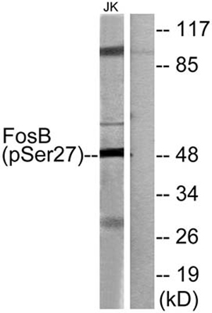 Fos B (phospho Ser27) Rabbit Polyclonal Antibody | 兔多抗 | EnkiLife恩玑生命