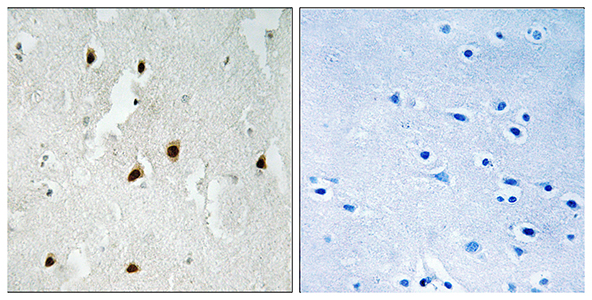 FoxO4 (phospho Ser262) Rabbit Polyclonal Antibody | 兔多抗 | EnkiLife恩玑生命